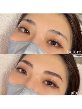 ダリ(Dali)/ハリウッドブロウリフト