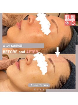 アンナカルナ(AnnaCarna)/フェイシャル専門店で輪郭美人に