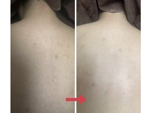 スリリアン 銀座/★お客さまビフォーアフター★