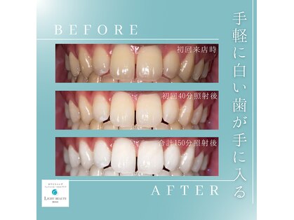 ライトビューティー 関内店(LIGHT BEAUTY)の写真
