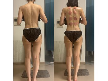 オーシャンブルーム 目黒(OceanBloom)/肩こり