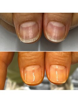プレシオサ ネイル(Preciosa Nail)/育成