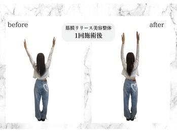 トキ(TOKI)/筋膜リリース美容整体 施術直後