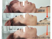 ビー アンド エイチ(B&H)の雰囲気（インディバヘッド&小顔フェイシャル）