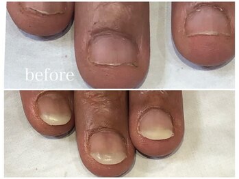 グレースレディ/ネイルNGでも！