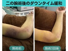 ナナ 銀座(Nana)/ダウンタイム短縮したい方へ