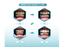 サロン ド スカイ(Salon de sky)/ホワイトニング7