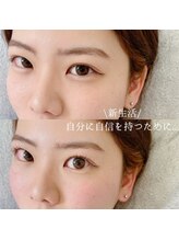 アイル バイ エドゥース(I'LL by et Douce)/まつげパーマ