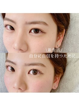 アイル バイ エドゥース(I'LL by et Douce)/まつげパーマ