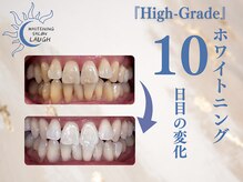 ラフ(LAUGH)/【審・美・白】 ホワイトニング