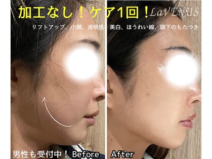 ラヴィナス 熊本下通(LaVENUS)の写真