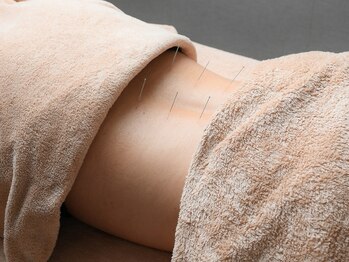 さくら鍼灸院 整骨院/施術8