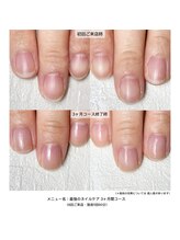 ネイルサロン ラピエトラ(la pietra)/最強のネイルケア３ケ月間コース