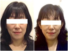 ウェリナ平和堂長久手院/小顔矯正/骨盤矯正/美脚サロン