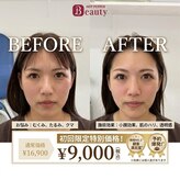 エスピーエー 桂坂(S.P.A)