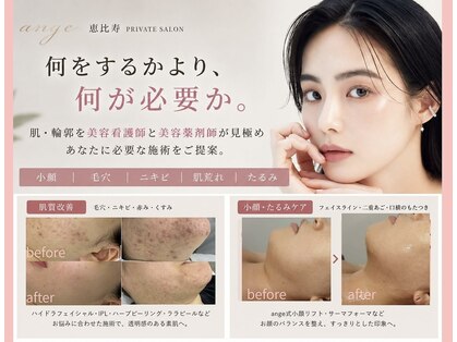 アンジェ(ange)の写真