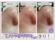 ルリアン(Lurian)の雰囲気（1回でも効果を実感できる結果重視のエステです！）