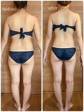 カレント(current)/ブライダルエステ¥13200