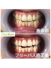 ルブラン 奈良店(Le Blanc)/お仕事帰りにケアを！