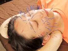 エイチスリー 表参道院/大人気の美顔鍼コース♪