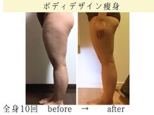 ボディデザインホームクレアフェリーチェ 神戸(Body design home Crea felice)/ボディデザイン痩身・全身