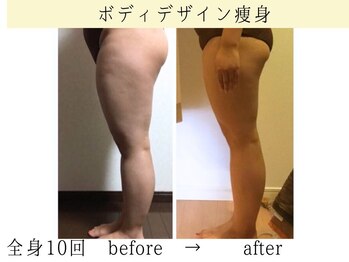 ボディデザインホームクレアフェリーチェ 神戸(Body design home Crea felice)/ボディデザイン痩身・全身