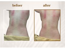 マーキュリー 乃木坂店(Mercury)/六本木/赤坂/乃木坂/リンパ/痩身