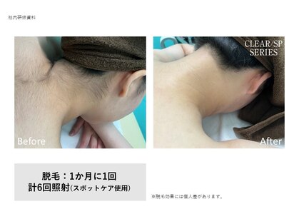 マイプラ(mypla)の写真