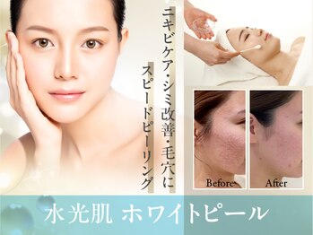 イーズ 武蔵小杉店の写真/『韓国水光肌ホワイトピーリング¥5500』背中・デコルテ・首のリンパの詰まりを流し、ピーリングの効果UPに!