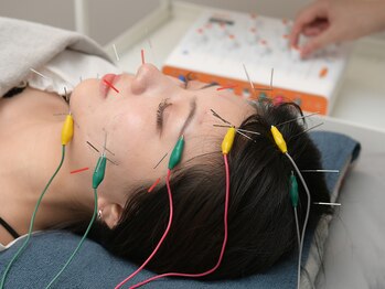 クラリ 徳重院(CLARI)の写真/鍼で丁寧にお肌を整え、たるみを改善したい！フェイスラインをスッキリしたい方へ◎