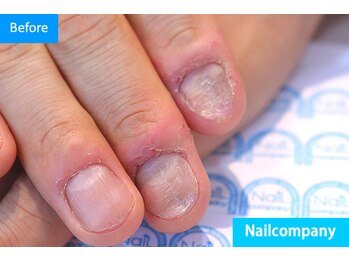 ネイルカンパニー/
