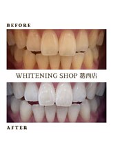 ホワイトニングショップ 葛西店/歯科提携 ホワイトニング専門店