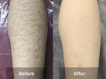 サロンズ ホット スパ ラニ(SALON'S HOT SPA Lani)/男性も大歓迎♪