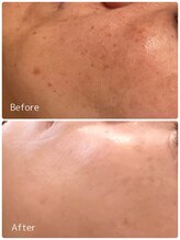 ククル(KUKULU)/ハーブ12回目♪（50代女性）