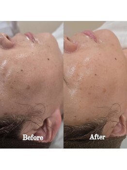 イチグラム(Ichi Glam)/ララピール効果