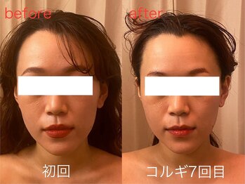 ビーキュート 神戸元町店(BE-CUTE)/コルギ7回目