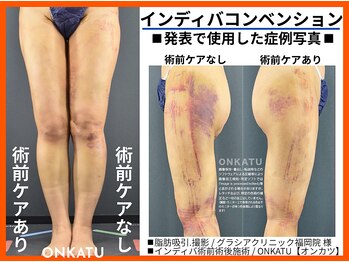 オンカツ(ONKATU)