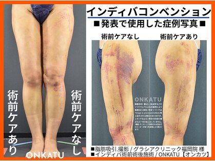 オンカツ(ONKATU)の写真