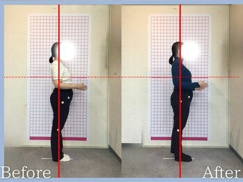 トロ整骨院(toro整骨院)/EMS8回★30代産後2ヶ月