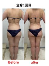 ステラ(Stella)/痩身1回目