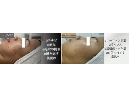 ファスール(Hwasoeur)の写真
