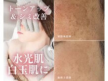 ハーボプラス(THE HEARBO plus)の雰囲気（くすみ・シミが気になる大人肌に♪透明感のある明るい素肌へ）
