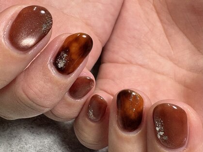 ブラウンネイル(brown nail)の写真