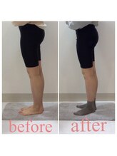 スタイルラボ高松/産後骨盤矯正の効果♪