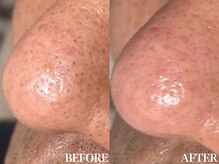 サロン ムスブ(salon MUSUBU)/山梨エステ/甲府エステ