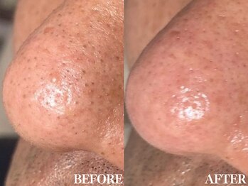 サロン ムスブ(salon MUSUBU)/山梨エステ/甲府エステ