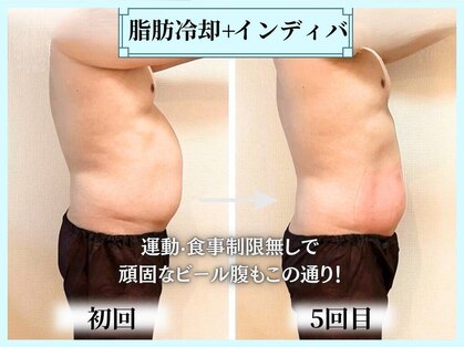 ブルー(Blue)の写真