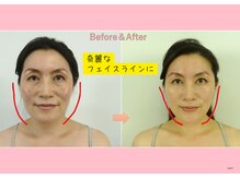 円山カラダ/奇麗なフェイスラインに