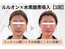 ヨサパーク ラ ぺ(YOSAPARK La paix)/引き締まったフェイスラインに☆