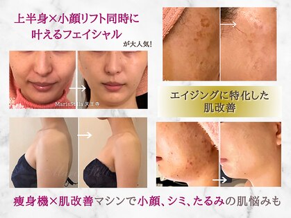 マリスステラ 天王寺(MarisStella)の写真